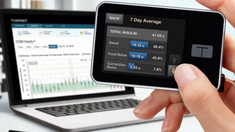 Consideraciones para la terapia con bomba de insulina