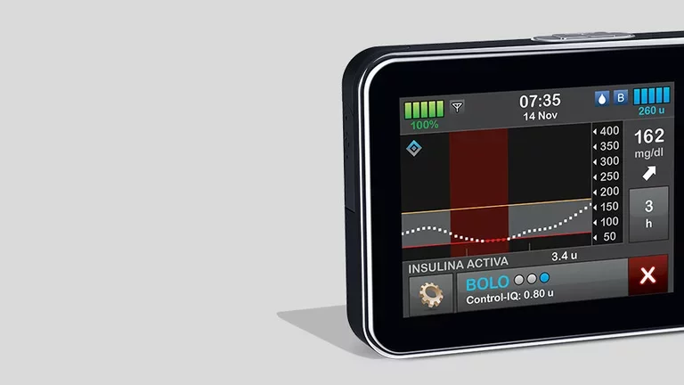 ¿Qué es una bomba de insulina?