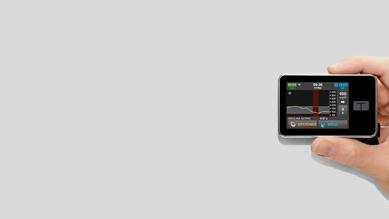 ¿Cómo imita una bomba de insulina el funcionamiento del páncreas sano?