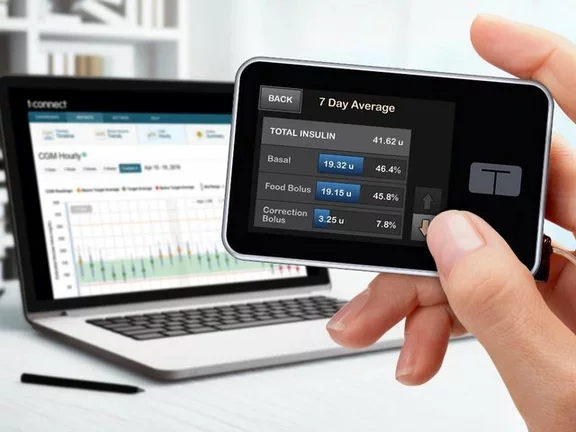 Consideraciones para la terapia con bomba de insulina