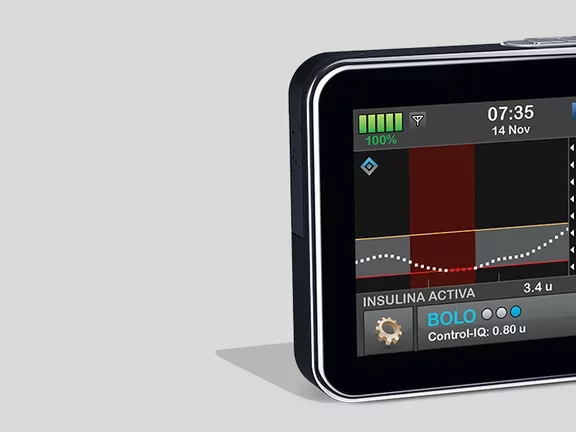 ¿Qué es una bomba de insulina?