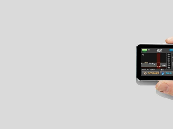 ¿Cómo imita una bomba de insulina el funcionamiento del páncreas sano?